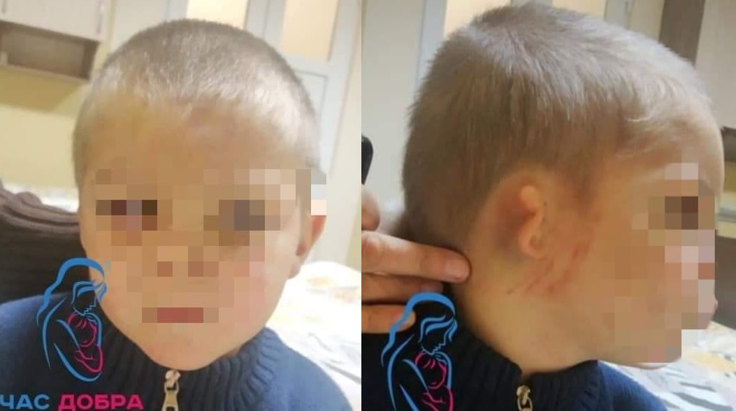 imgonline com ua 2to1 bIozyREBBnSU0e