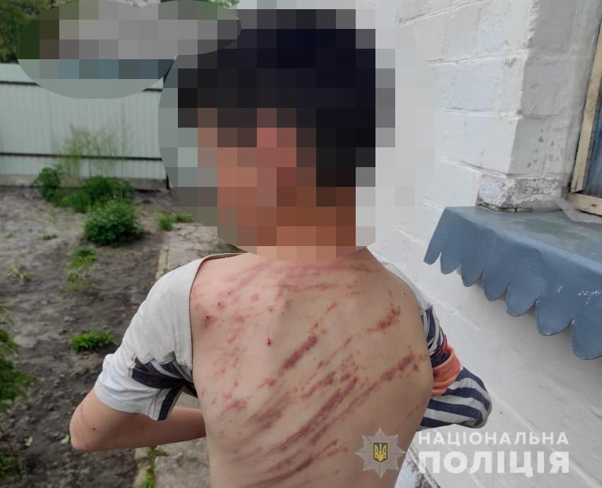 10 06 tilesni ushkodzhennya 2