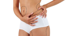 Ін'єкційна косметологія 