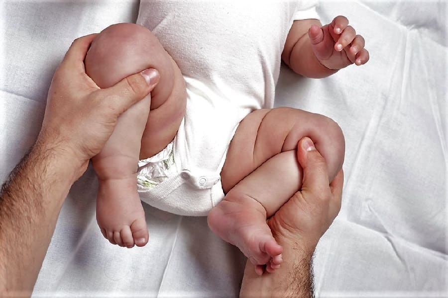 Дисплазія у немовлят