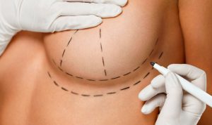 Найпопулярніші процедури пластичної хірургії у Intima.Clinic