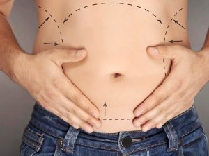 Ліпосакція та ліпомоделювання